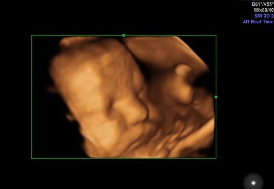 What will a 4D baby scan show me?