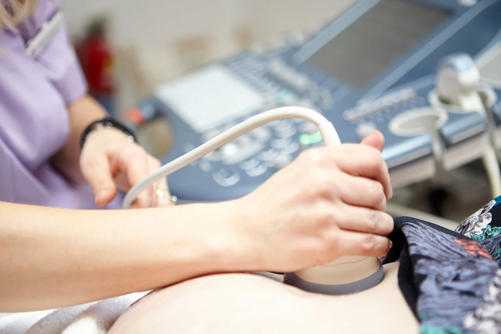 What Is a HD Live Baby Scan and Do I need One?