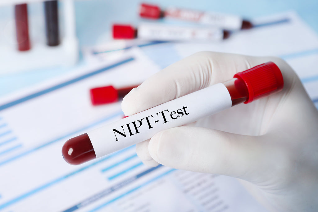 The Benefits of NIPT: A Gentle Guide to Non-Invasive Prenatal Testing